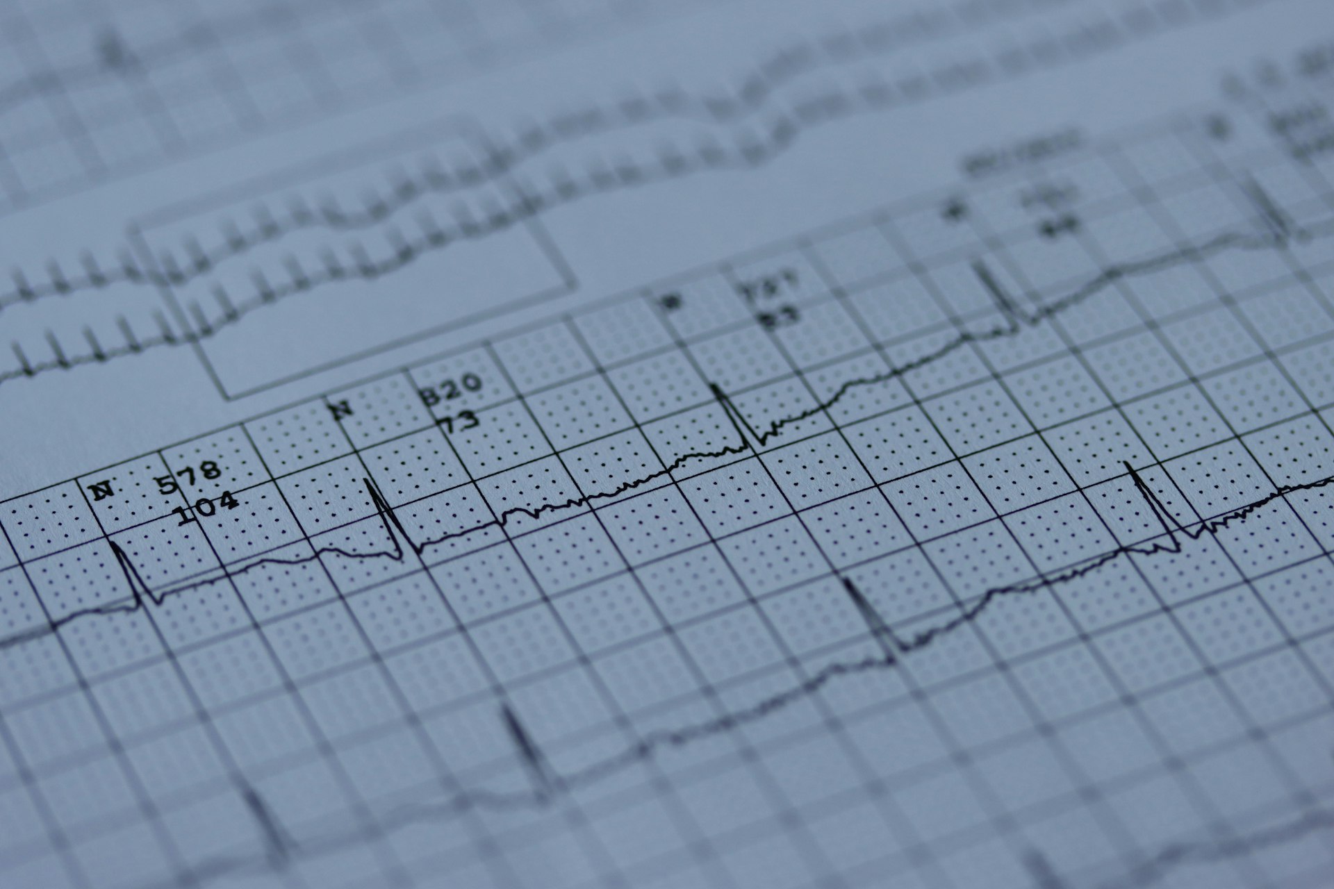 Understanding the Link Between Bodily Rhythms and Daily Tension Regulation
